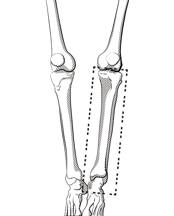 tibia-field.png